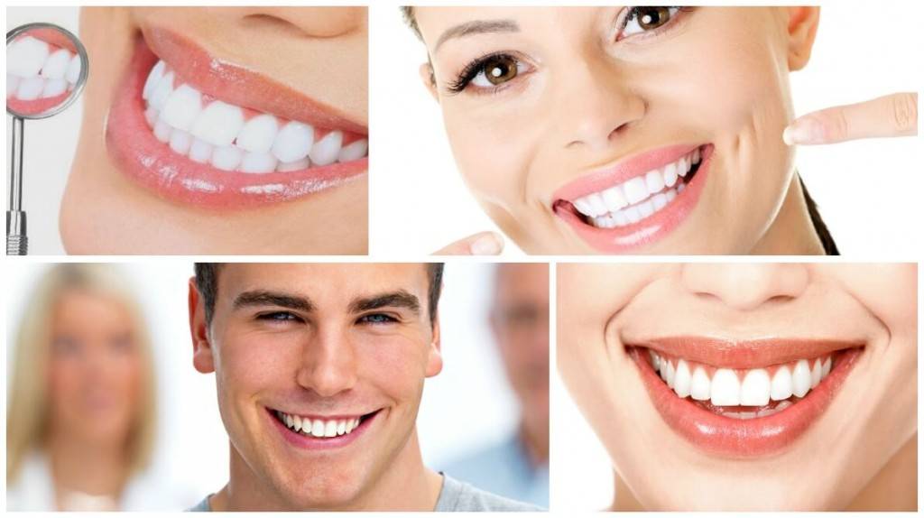 Blanqueamiento dental Valencia de calidad - Imágenes de blanqueamiento dental