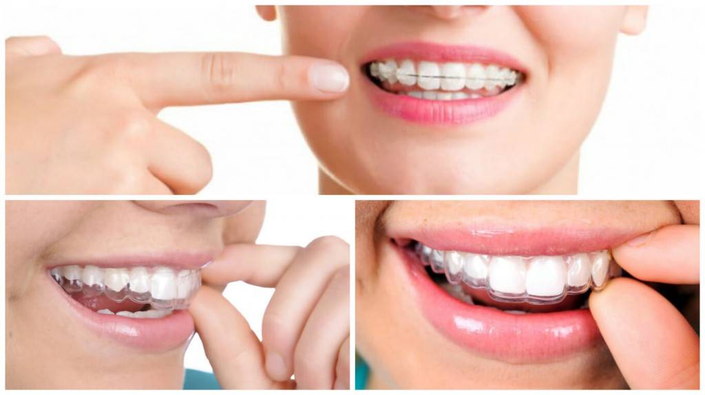 Tratamientos dentales - Imagen de varios tratamientos
