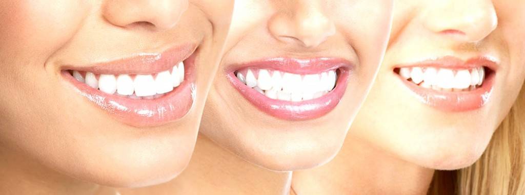 Odontología estética Valencia - Tratamientos de estética dental