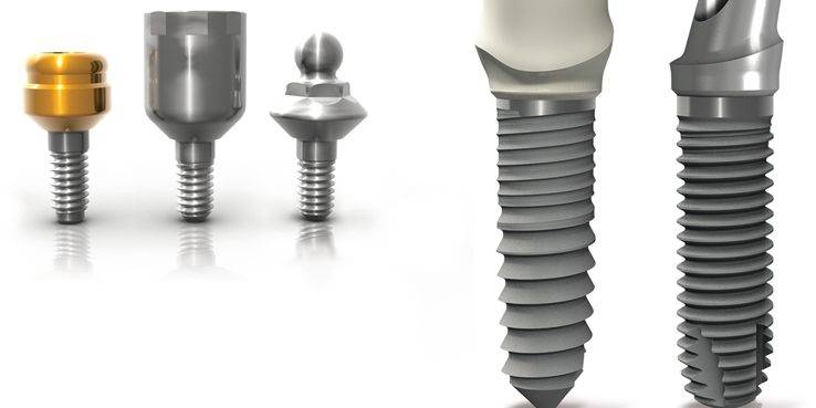 Precio para implantes dentales en Valencia