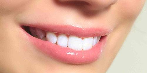 Estética dental Valencia