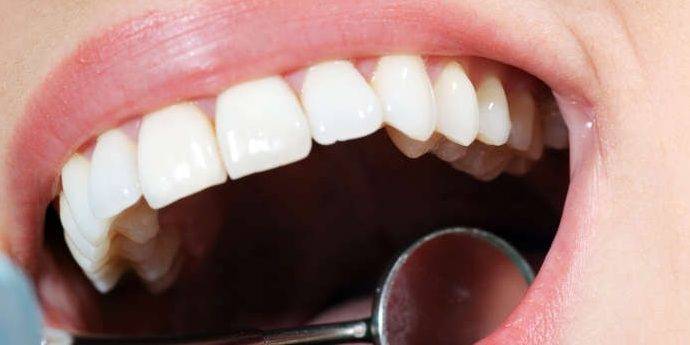 Odontología conservadora Valencia