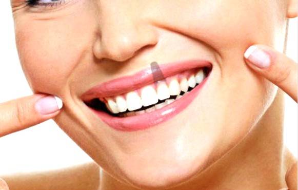 Implantes Valencia – Clínica profesional y con experiencia