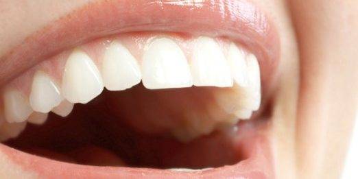 Odontología estética Valencia – Sonrisa perfecta