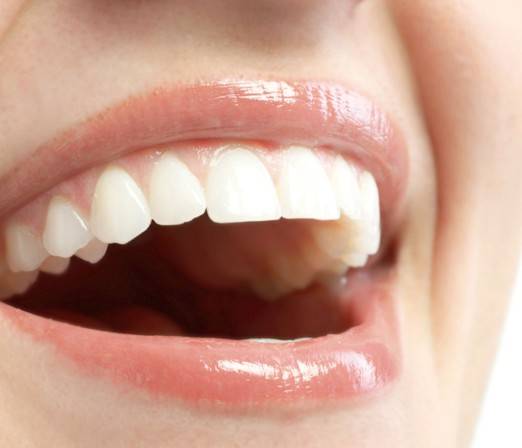 Odontología estética Valencia – Sonrisa perfecta