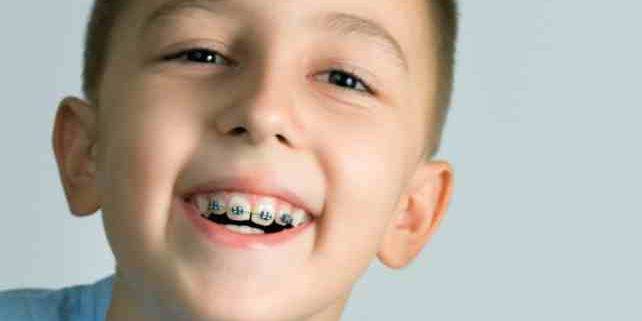 Ortodoncia infantil Valencia – Tratamientos de calidad
