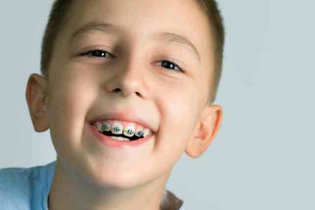 Ortodoncia infantil Valencia – Tratamientos de calidad