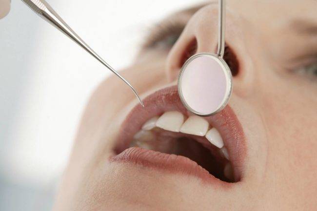 Dentistas Valencia – Odontólogos profesionales