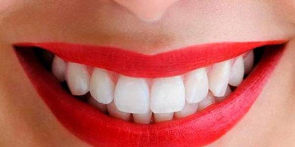 Última tecnología en blanqueamiento dental Valencia Última tecnología en blanqueamiento dental Valencia