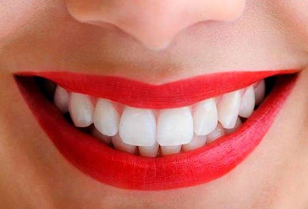 Última tecnología en blanqueamiento dental Valencia Última tecnología en blanqueamiento dental Valencia