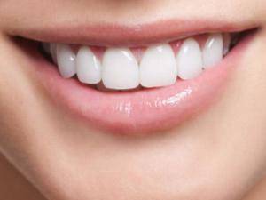 Le ofrecemos el mejor precio en implantes dentales Valencia