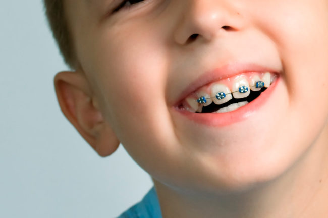 Clínica de ortodoncia infantil Valencia Clínica de ortodoncia infantil Valencia