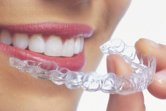 Invisalign provider Valencia